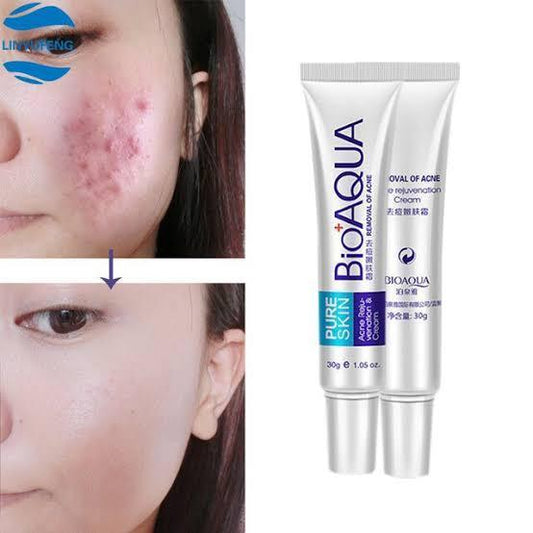 Acne Removal cream by Bioaqua