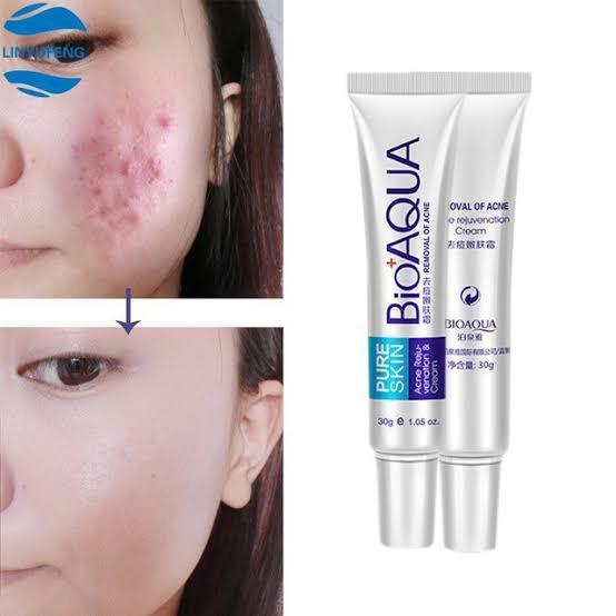 Acne Removal cream by Bioaqua